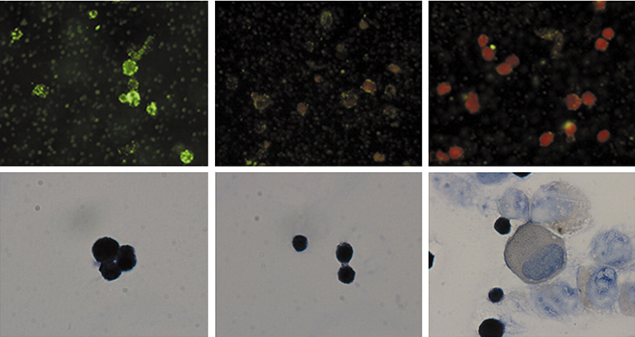 Tumor-associated myeloid cells (TAMC) produce arginase I